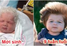 Bất ngờ với 14 em bé sơ sinh có mái tóc kì lạ ‘nhất hành tinh’